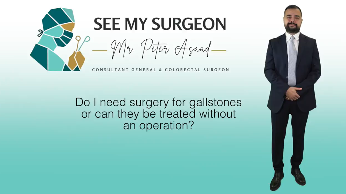 do i need surgery for gallstones or can they be treated without an operation?