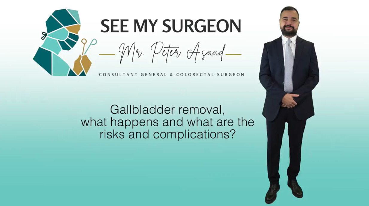 gallbladder removal - what happens and what are the risks and complications